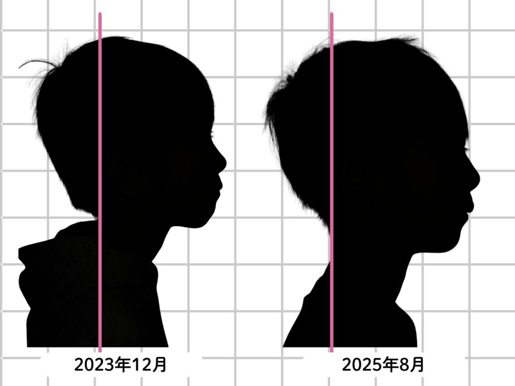 旭川駅前あしたばデンタルクリニック_2026_02_27_小児矯正