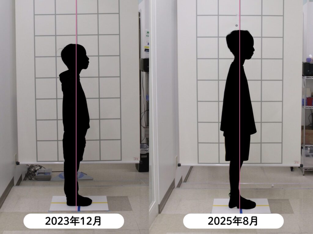 旭川駅前あしたばデンタルクリニック_2026_02_27_小児矯正